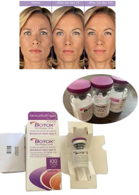 China Anti Wrinkle  Botulinum Toxin Allergan 100IU 150iu ' Na for sale