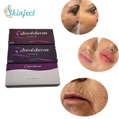 China Juvederm ultra 4 Huidinjecties van de Vullerlip voor Sexy Lippenverhoging Te koop