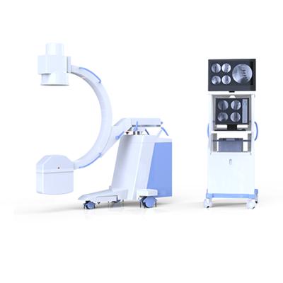 China Hot Selling Brands Hospital Digital C Arm Fluoroscopy C Arm Machine Price Metal Ultra Low Illumination Nantong CE CCD Camera Imported From Japan for sale