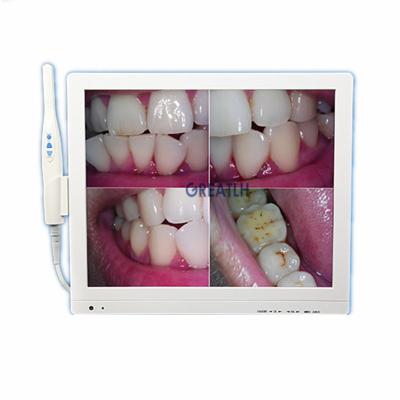 China Plastic Dental 17 INCH MONITOR WITH Oral Intra Macro Camera 6-LED HD Lens With Glass Seal Dental Clinic Equipment for sale