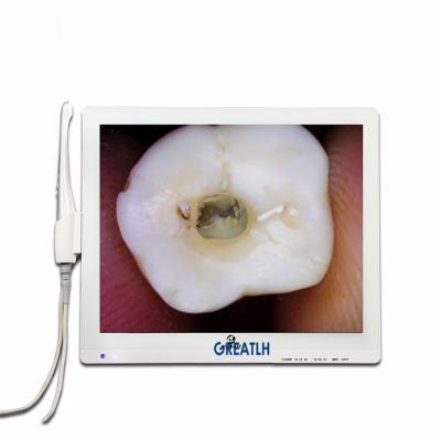 China Intraoral Plastic Oral Camera With 10 Dental LED Oral Camera With 17 Inch Monitor HD Screen Dental Lab/Dental Mechanic Aquipment for sale