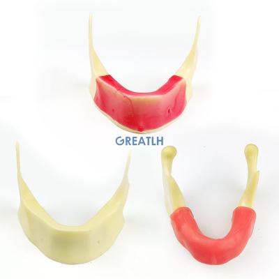 China Tooth Model Practice Simulated Teaching Model Bionic Mandibular Tooth Mandible Regional Dental Model for sale