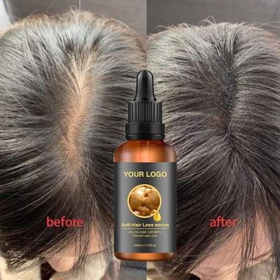 China Daily Hair Loss Growth Oil Hair Loss Products Replenishing Organic Ginger Essence Treatment for sale