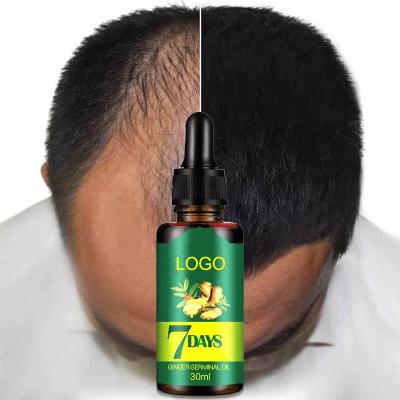 China Best Loss Prevention Private Label Hair Growth Oil Hair Growth Ginger Germinal Oil Bald Hair Growth Serum for sale