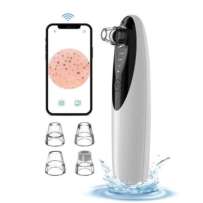 China Acne Treatment Skin Care Product Latest Rechargeable Pore Clean Electric Vacuum Blackhead Visual Remover With Camera for sale