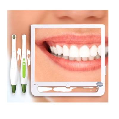 China Best Dental Dental Intra Oral Camera Wireless Scanner Intraoral for sale