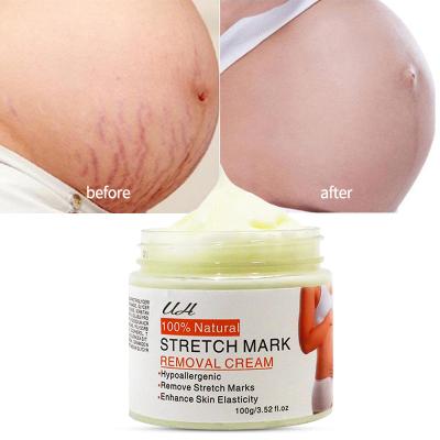 China Nourishing Stretch Mark Prevention Cream Scar And Stretch Mark Remover Cream Hypoallergenic And Paraben Free Stretch for sale