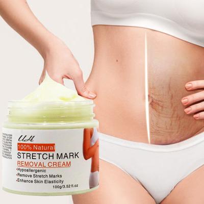 China Shea Butter And Vitamin e Stretch Mark Cream For Pregnancy Lotion Nourishing Natural Stretch Mark Removal Cream for sale