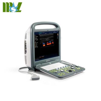 China Cheapest Innovative Portable Color Doppler Ultrasound Machine Sonoscape S2 15 LCD for sale