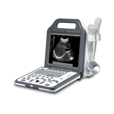 China Clinic MSLPU51 Medical Ultrasound Machine For Pregnancy Full Digital Design for sale