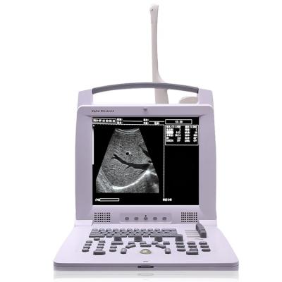 China MSLPU49 Smart Portable B/W Full Digital Ultrasound Scanner With High Resolution for sale