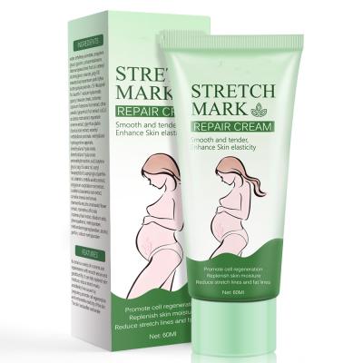 China Postpartum Exfoliator Stretch Mark Cream To Relieve Obesity Lines, Line Growth Repair Cream To Soften And Increase Elasticity 60g for sale