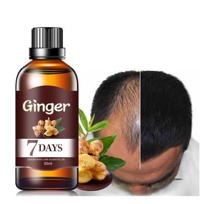 China Loss Prevention 7 Days Nourishing Scalp Repair Damaged Essential Oil Ginger Germinal Bald Fast Hair Growth Serum For Men for sale