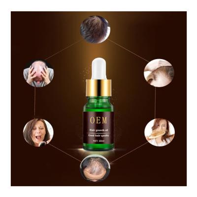 China OEM Private Label Hair Loss Treatment Oil Natura Loss Prevention Regrow Ginger Germinal Serum Hair Growth Oil for Man and Woman for sale