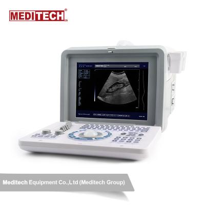 China Multi Portable B/W Ultrasound Scanner, 8 TGC Controls Cine-Loop B.2B.B/M.4B Display USB Port To Transfer Data From Ultrasound for sale