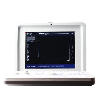 China Multi B/W High Quality Portable Ultrasound Scanner , Display 4B USB Port To Transfer Data for sale