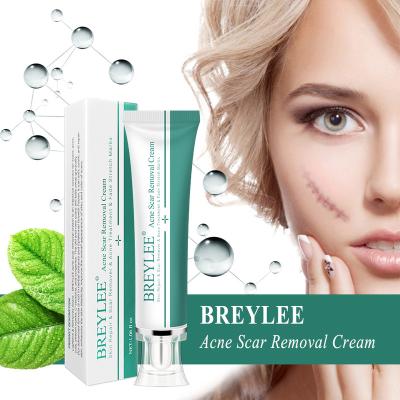 China BREYLEE Acne Treatment Natural Acne Treatment Gel Skin Repair Acne Marks Marks Removal Cream for sale