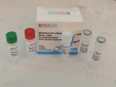 China Kit de detecção de PCR de fluorescência em tempo real de alta precisão para o vírus da catapora à venda