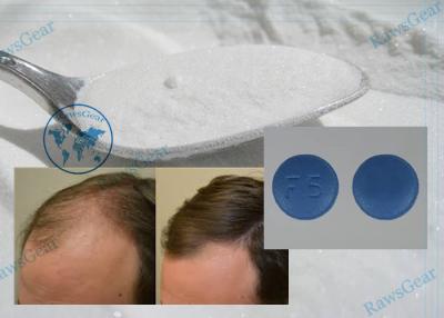 China Hot Sale Finasteride Powder Large Stock Help Improve Hair Loss Low Price Made In China 98319-26-7 for sale