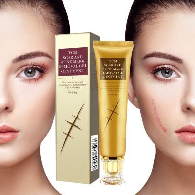 China Acne Treatment Landora Scar Cream To Remove Scar On Face Pimples And Oak Cream And Whitening Skin All Skin Type for sale