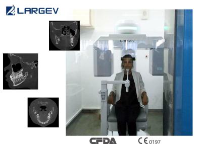 China LargeV Hires3D dental imaging systems with better -imaging progress system and Metal Artifact removal for sale