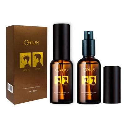 China CE OEM Alcohol Free Factory Most Popular Ginger Hair Growth Oil For Hair Regrowth Sets 15Days Ginger Anti Hair Loss Products for sale