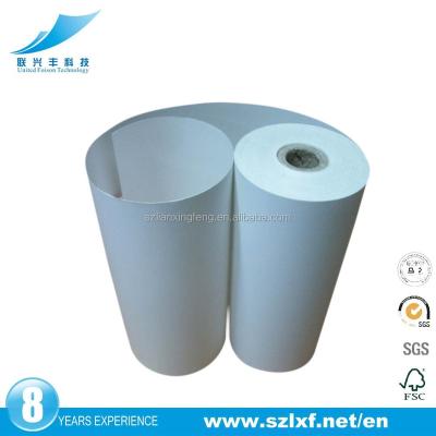 China UP-110S Medical Paper Use for Sony Printer for sale