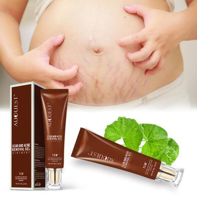 China Acne treatment TCM scar repair gel stretch marks removal cream acne treatment desalt scar use for body and face fast no side effects gel for sale