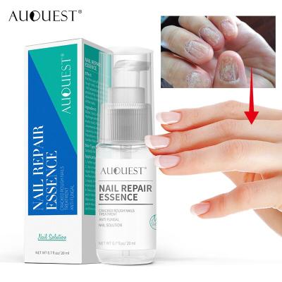 China Anti Fungal / Leuconychia Fast Repair Nail Effect Serum Split Nail Rough Treatment Anti Fungal Solution Foot Rub Finger Toe Nail Polish Foot Care for sale