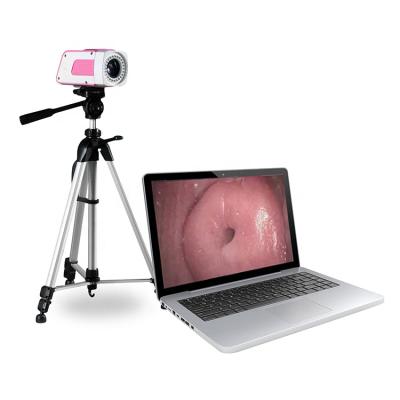 China SW-3301 Colposcope Portable Laptop Digital Digital Colposcope Visual Colposcope with SW-3301 Software for sale