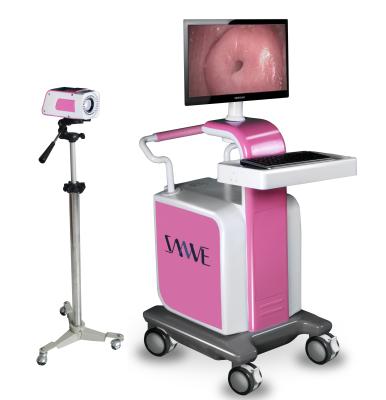 China SW-3303 Digital Colposcope Digital Visual Electronic Colposcope Digital Optical Colposcope SW-3303 for sale