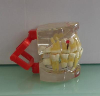 China Show deciduous teeth structure hot sale child pathological temporary tooth teaching model for sale