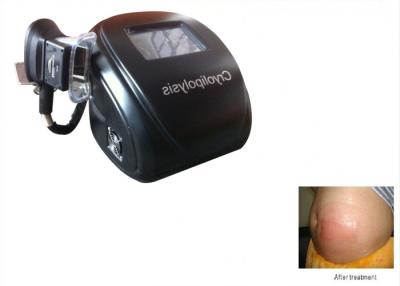 China Do gelo fresco portátil da máquina do emagrecimento de Cryolipolysis Velashape remoção gorda 220V/50Hz à venda