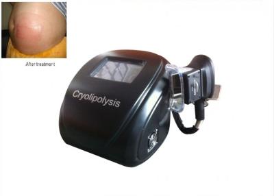 China 8 inch touch screen Cryolipolysis freeze fat cells , fat reducing machine 110V /  60Hz for sale