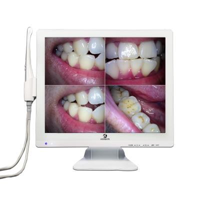 China Dental Regional High Quality Camera Dental Oral Camera 1280*1024 Intra 17 Inch Monitor Teeth for sale