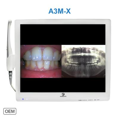 China Dental Intraoral HD Camera Lens Macro Camera Lens Eco-friendly LCD Intraoral Camera Image Sharing Wireless Intraoral Camera for sale