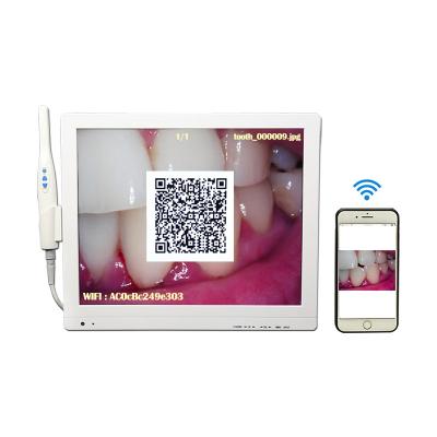 China Metal VISUAL DIGITAL CAMERA Whitening Teeth Machine Waterproof Digital Intraoral Camera for sale