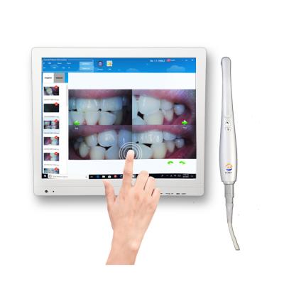 China A6M-X Dental Equipment Dental Intraoral Wireless Odontologi Touch Screen Camera Clinic Instrumental Dental Oral Endoscope Camera for sale