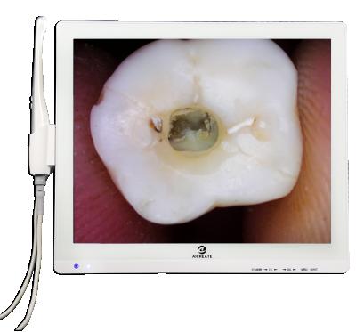 China Sealed camera head with A3S-X camera sd card storage wifi image glass super clear dental intraoral share to smart phone with 17 inch monitor and metal bracket for sale