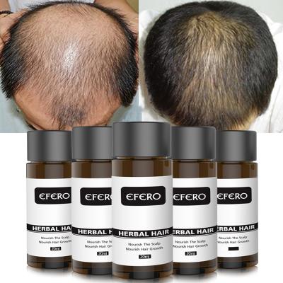 China EFERO Hair Growth Essence Oil Fast Powerful Hair Loss Products Essential Oil Hair Treatment For Women Men Hair Care Products 20ml for sale