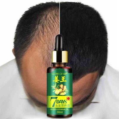 China Effective 30ML Ginger Hair Growth Treatment Hair Growth Essence Oil Hair Loss Products 41 for sale