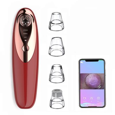 China Fast Pore Obvious Facial Remover Acne Treatment Blackhead Remover USB Blackhead Fast Filling Instrument for sale