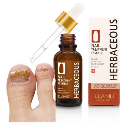 China 30ml Nail Repair Onychomycosis Foot Care Anti Infection Anti Infection Fungal Toenail Repair Essence Wholesale Effective Onychomycosis Toe Nourishing Care for sale