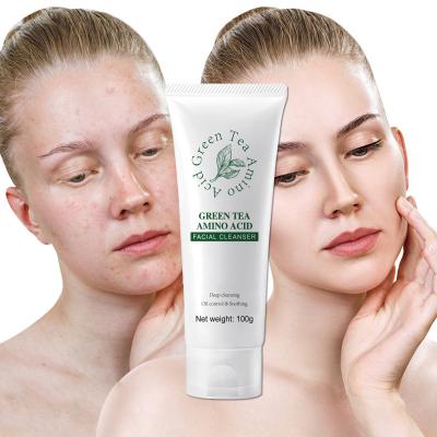 China Acne Treatment Private Label Face Care Acne Faicial Detergent Foaming Cleansing Whitening Face Wash For Beauty for sale