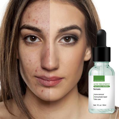 China Skin Revitalizer Tea Tree Natural Organic Herbal Skin Care Remove Acne Repair Treatment Face Night Serum For Beauty Lady for sale