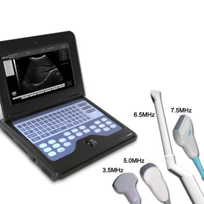 China Cardiac CE APPROVE Laptop Ultrasound Therapy Machine Portable Ultrasound Scanner B Ultrasound Machines for sale