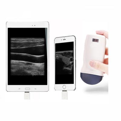 China DIGITAL PORTABLE Medical Ultrasound Machine of SYSTEM B B/M Color PW PDI Mini Wireless Probe Type Portable ULTRASOUND for sale