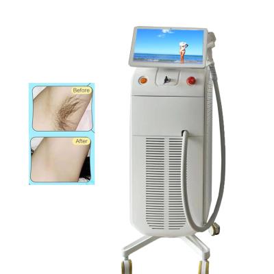 China 2000W Professional Laser Removal Machine 808nm Diode Laser Hair Removal System Intelligent for sale