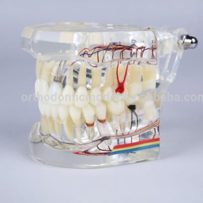 China implant model with pathologies for dental study M2001-2 hospital and school model for sale