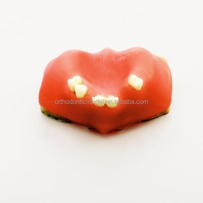 China Eco-friendly Implant Tooth Model With Soft Gum For Student Practice With Sinus Lift Tooth Model for sale